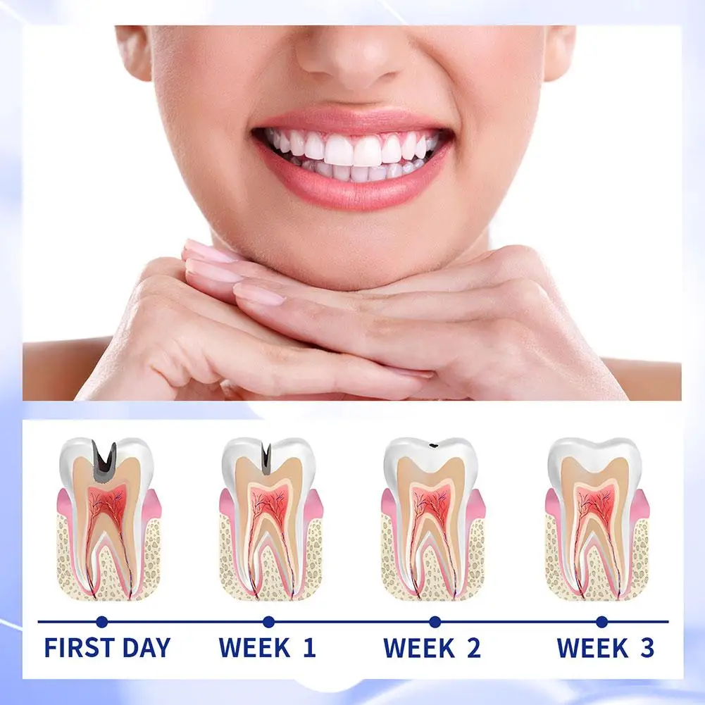 Teeth Whitening Product Teeth Whitening Essence Teeth Health Product Tooth Decay Repair Anti Decay Toothpaste Repairing Dental Caries Teeth Whitening Soda Removing Dental Plaque Tooth Prote M1f6