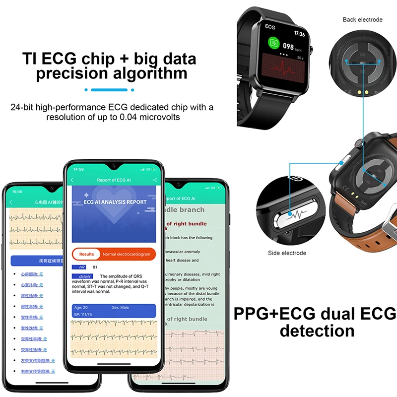 2020 ο Ʈ ġ ECG + PPG  ڵ ü  Smartwatch ƮϽ   ð