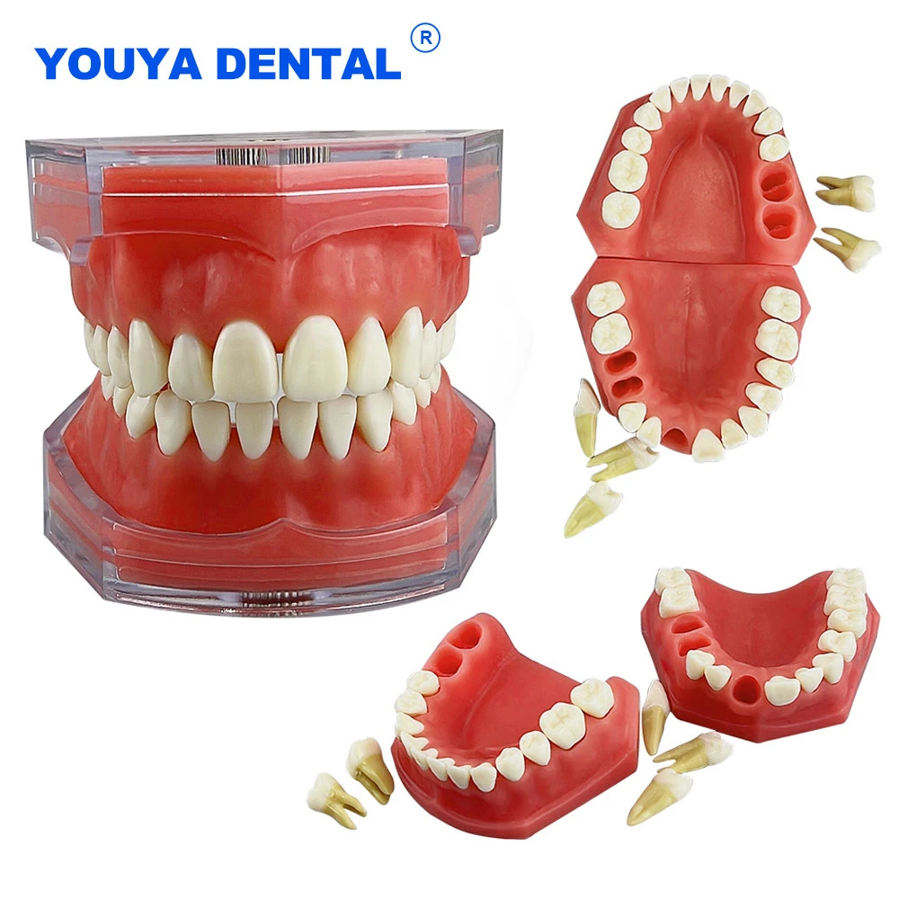 Dental Model Removable Teeth Model Detachable Implant Soft Gum Tooth