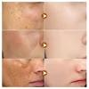 Powerful Dark Spots Remover Whitening Serum Face Freckle Melanin Correcting Anti Pigmentation Brighten Skin Beauty Care Essence 2