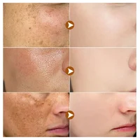 Powerful Dark Spots Remover Whitening Serum Face Freckle Melanin Correcting Anti Pigmentation Brighten Skin Beauty Care Essence 2