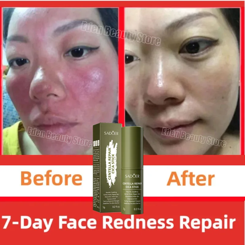 

Instant Repair Facial Redness Multi Bounce Balm Face Sensitive Skin Treatment Korean Anti Red Nose Balm Stick Skin Care Products