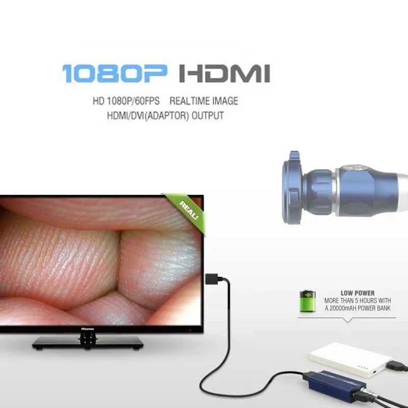 CY-FHD 디지털 휴대용 내시경 카메라 시스템, USB HD 1080p
