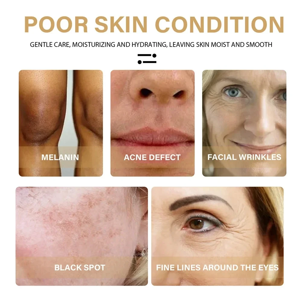 Turmeric Whitening Freckles Serum Remove Dark Spots Melasma Brighten Lighten Melanin Improve Dull Anti-aging Face Skin Care 10ml 4