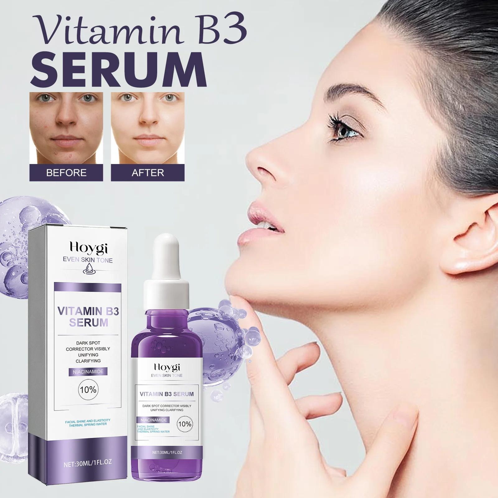 Whitening Serum Dark Spots Remover Anti Pigmentation Beauty Care