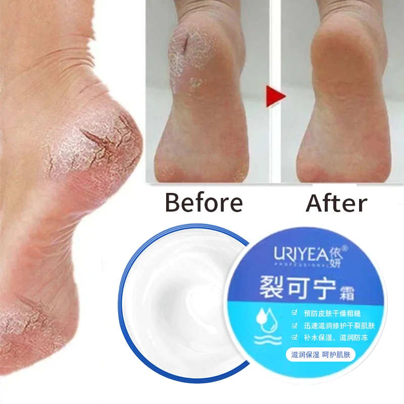 

2pcs Anti Crack Foot Cream Oil Anti-Drying Crack Feet Cream Heel Cracked Repair Cream Removal Bad Skin Hand Feet Care Mask