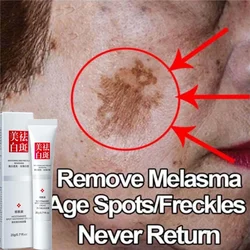 Fast Freckles Removal Facial Essence Remove Melasma Facial Spots Skin Dark Spot Sunspots Whitening Sunspots Freckle Cream