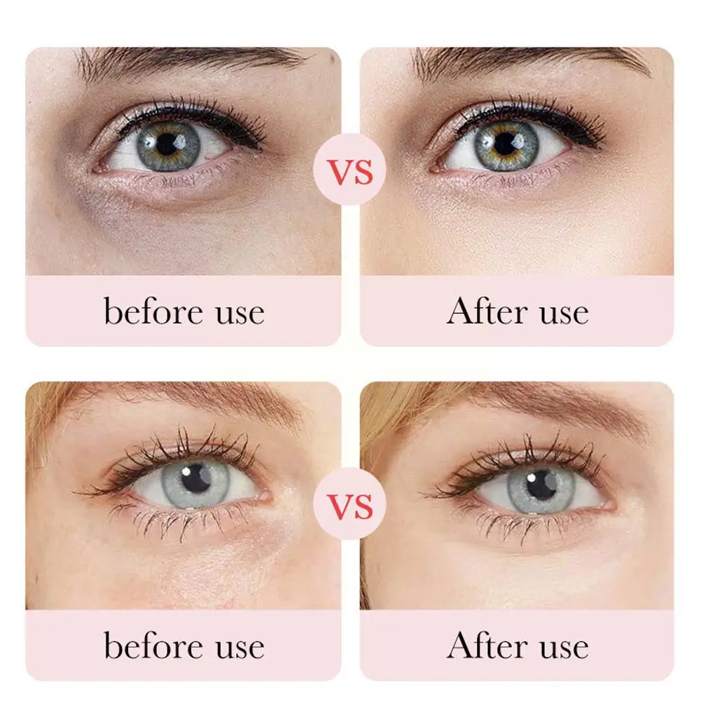 Рисунок 2 - Увлажняющая Маска для кожи вокруг глаз