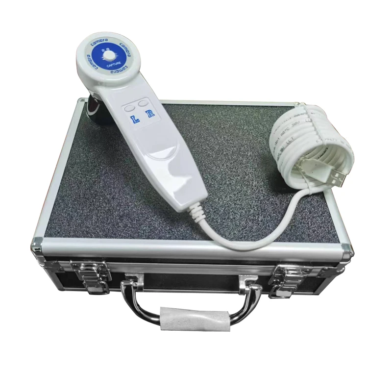 Hot selling iriscope iris analyzer iridology camera with pro iris software 3