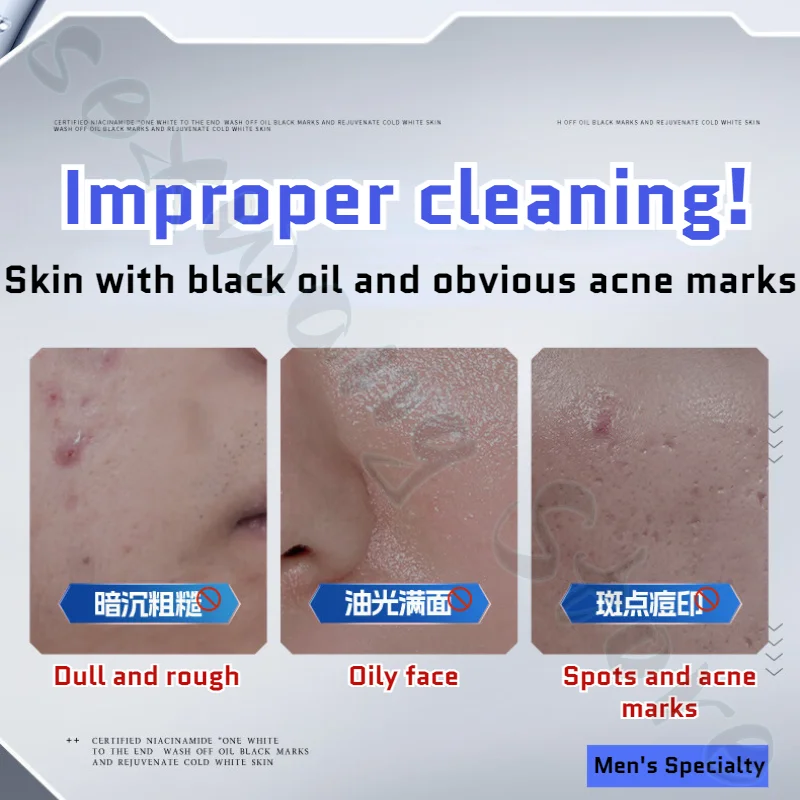 150ml Facial Cleanser To Remove Darkening Brighten Skin Tone Clean Pores Control Oil Shrink Pores Men's Special Facial Cleanser