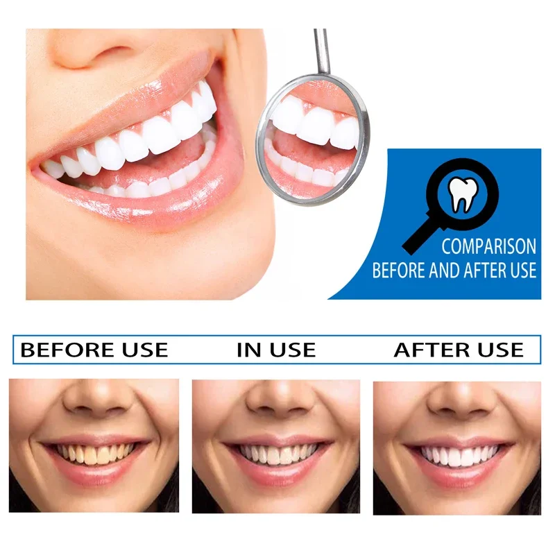 Teeth Whitening Essence Remove Plaque Stains Serum Oral Hygiene Against Dental Caries teeth whitening essence teeth whitening product teeth health product