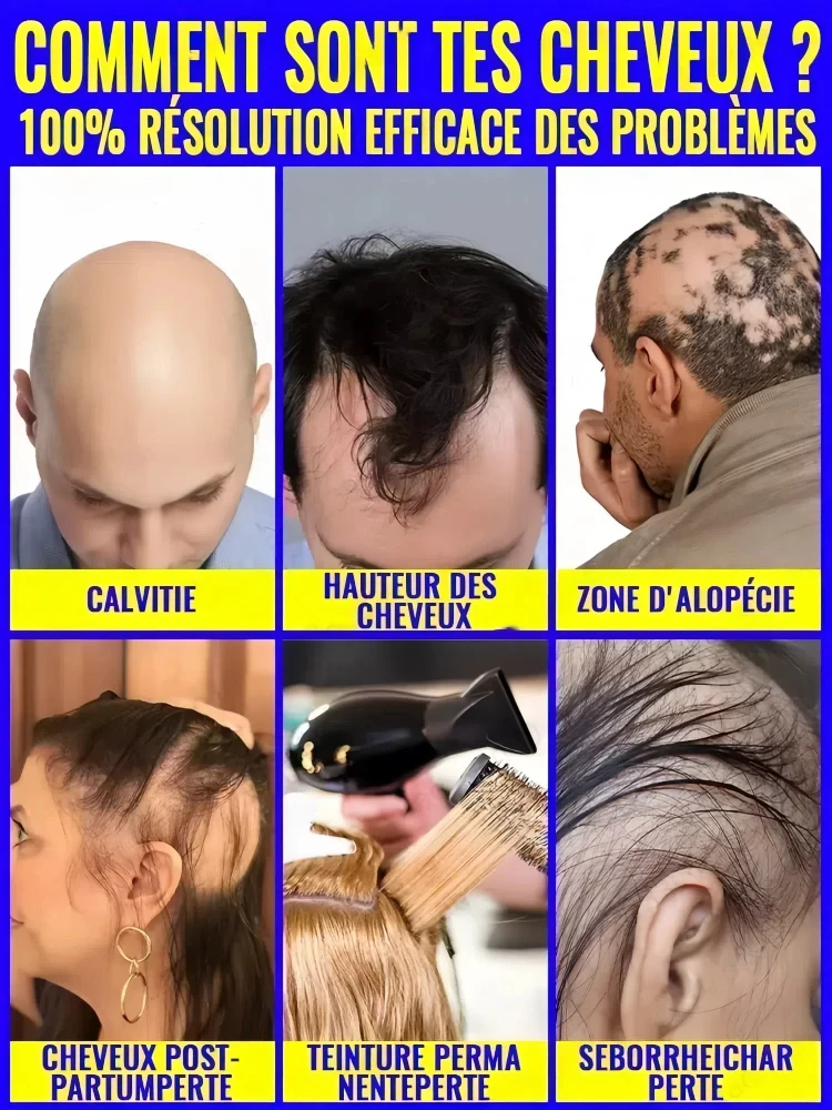 Revive Hair Strong Penetration Activate Hair Roots More Hair Say Goodbye to Baldness Thick Hair hair growth serum hair building powder hair building fibers hair growth spray hair growth cream hair growth shampoo set