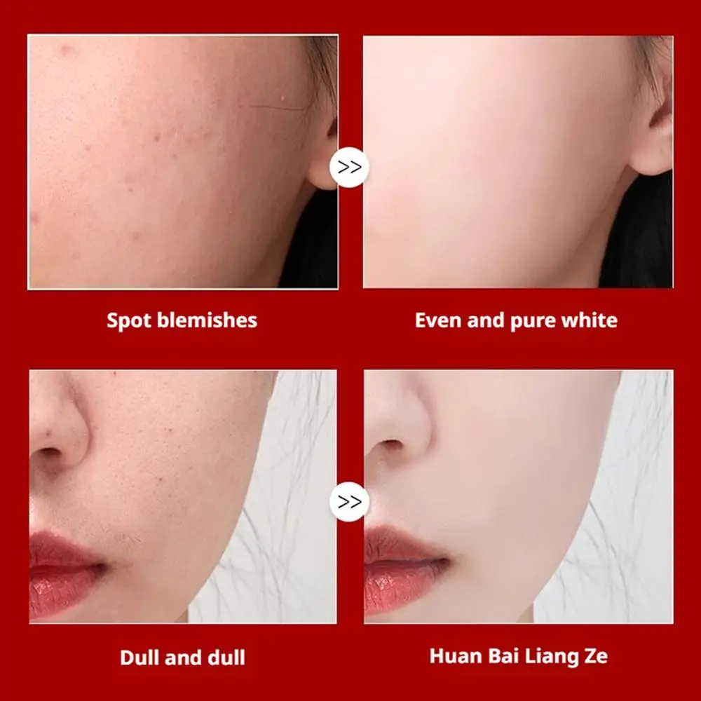 كريم تبييض كوري للعناية بالبشرة وإزالة البقع، يتلا...