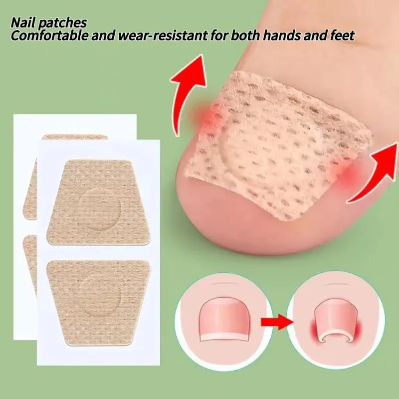 2/6/12Pc Ingrown Toenail Toe Correction Stickers Nail Art Foot Patches Feet Care Paronychia Treatment Recover Pedicure Foot Tool