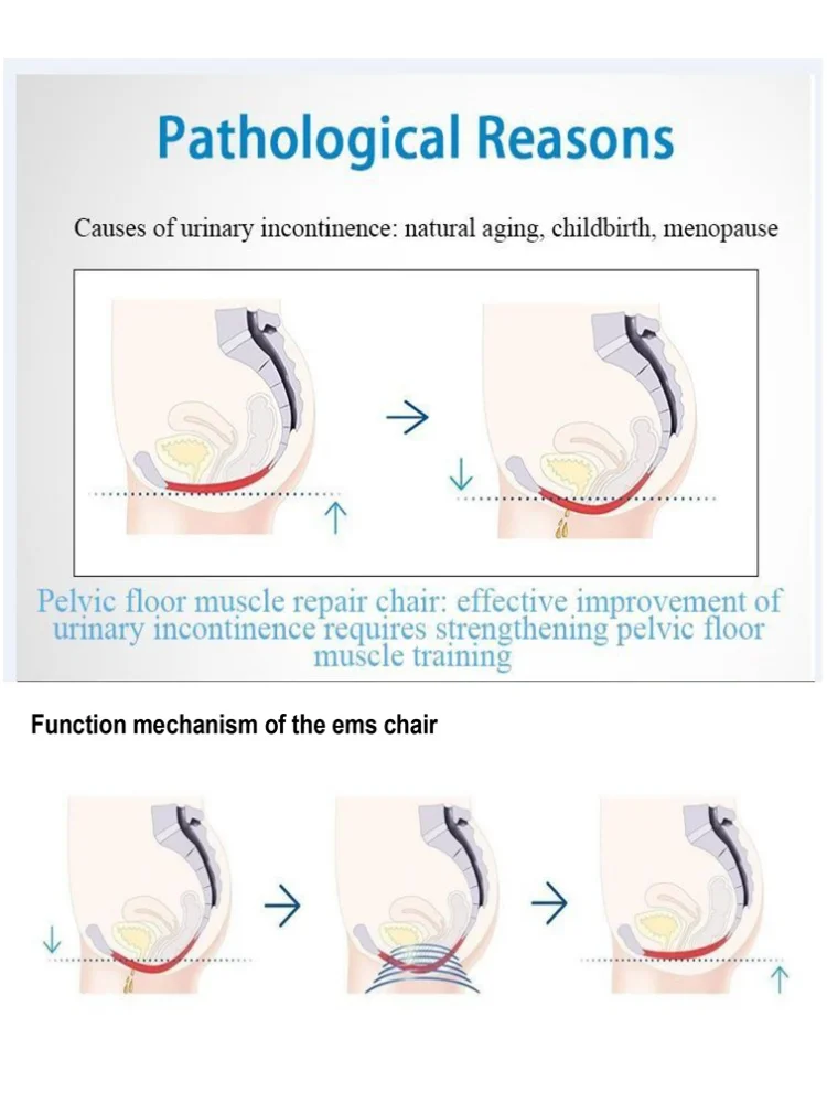 Newest Ems Pelvic Floor Chair Urinary Incontinence Rehabilitation Machine Exercise Muscle Repair Stimulator 5