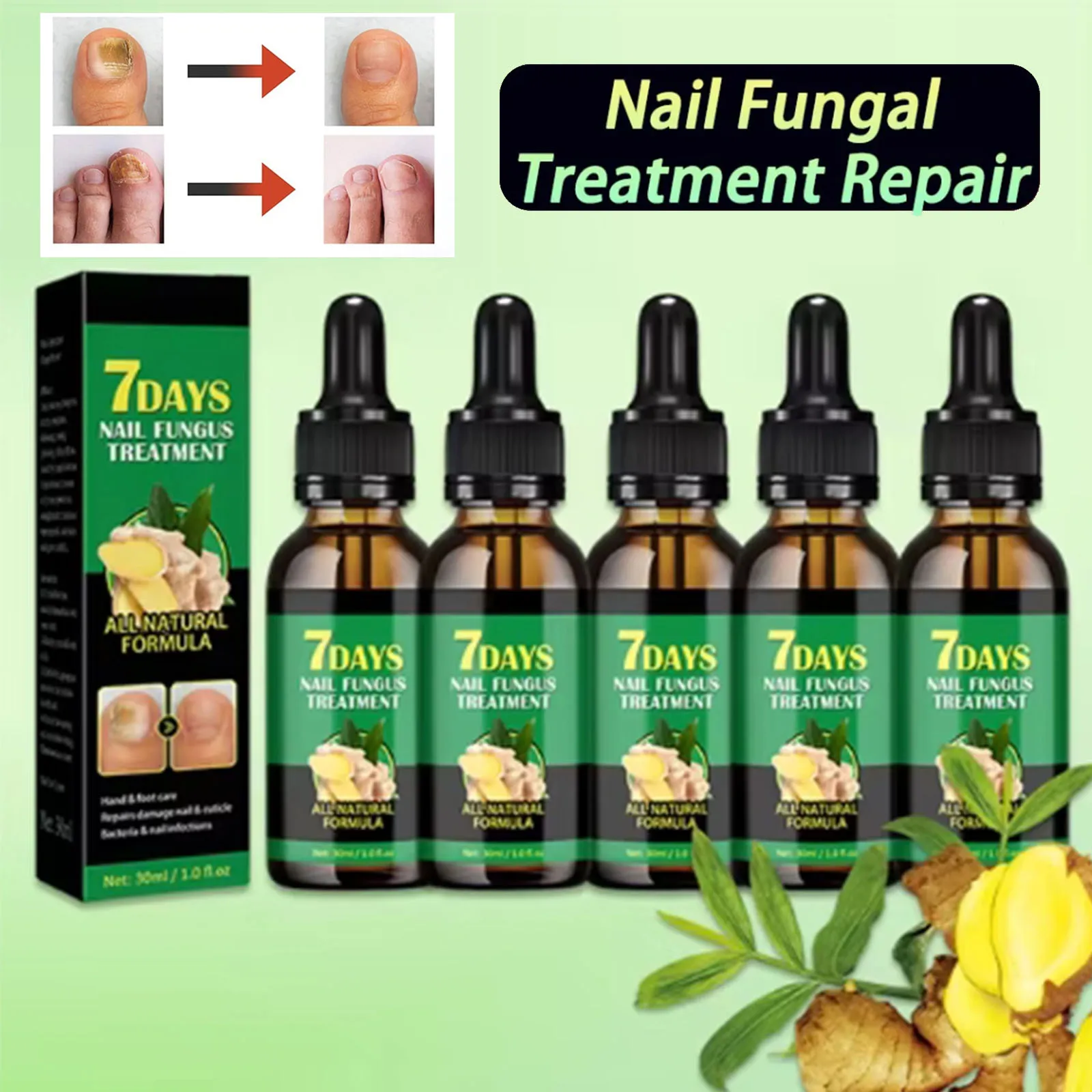 Nail Fungus Remover Personal Health Care Manicure Pedicure Tools Nail Fungal Treatment Device 1-5Pcs