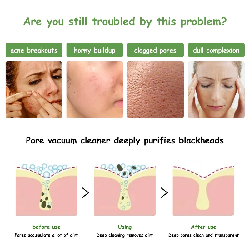 Face Mask 110g Green Tea Ice Muscle Mud Mask Deep Cleansing Remove Blackheads And Shrink Pores Mask Facial Skin Care