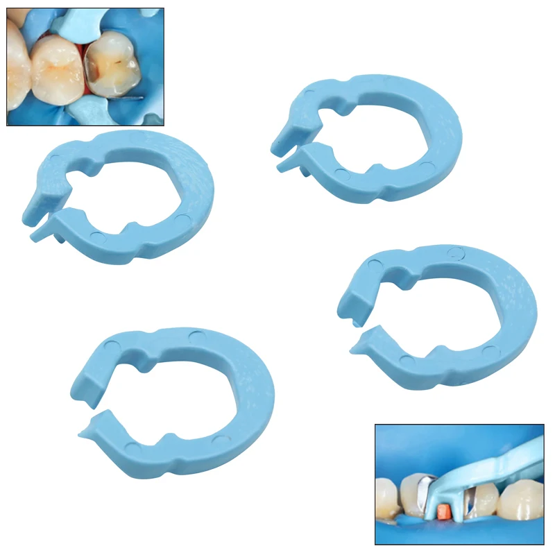 

4pcs/box Dental Resin Clamping Ring Separator Ring Sectional Contoured Metal Matrices Holder Matrix Fixed Clamp Autoclavable