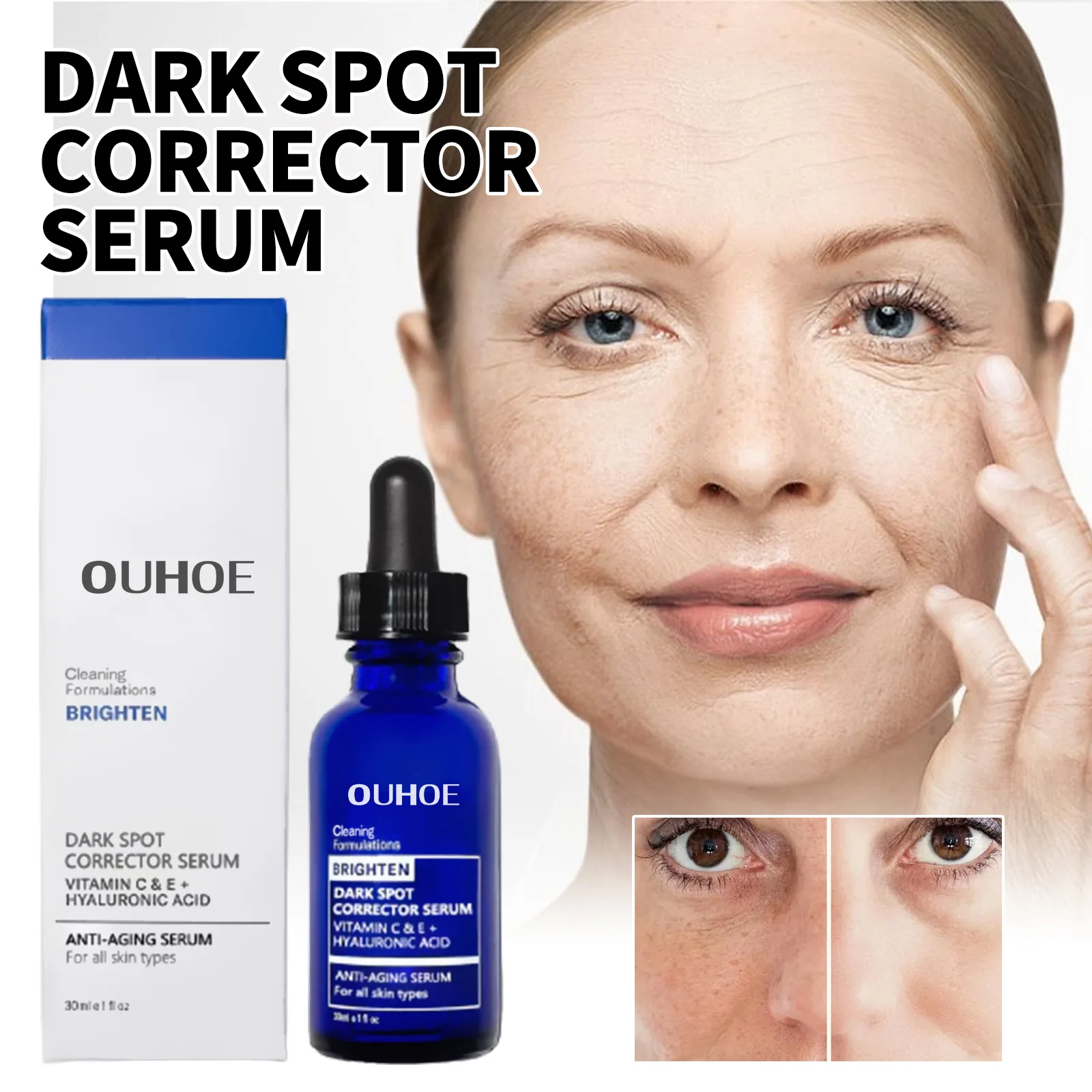 Dark Spot Corrector Serum Repairing Pimples Acne Removal Whitening Dullness Spots Moisturizing Firming Freckles Remover Essence_voghion.com