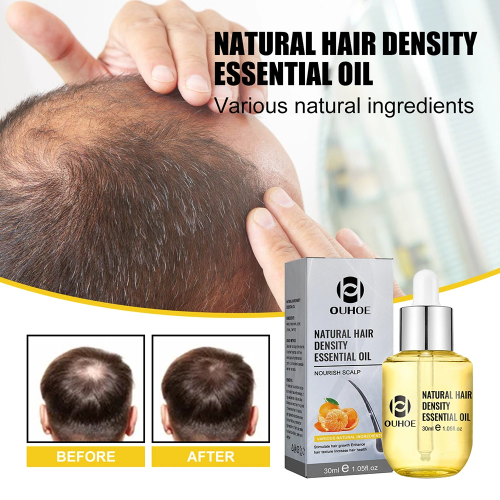 Natural Hair Growth Essential Oil Ginger Essence Hair Regrowth Thicken Treatment Anti Loss Gift Set For Men Women