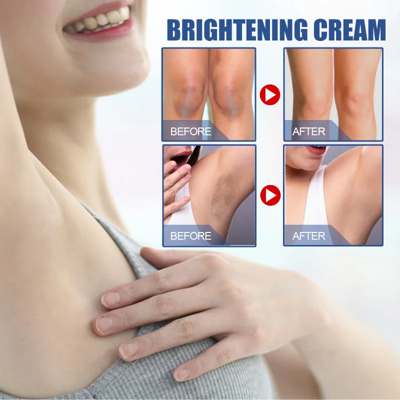 10 Seconds Instant Bellezon Whitening Cream Underarm Armpit Whitening Cream Legs Knees Private Parts Body 60ml
