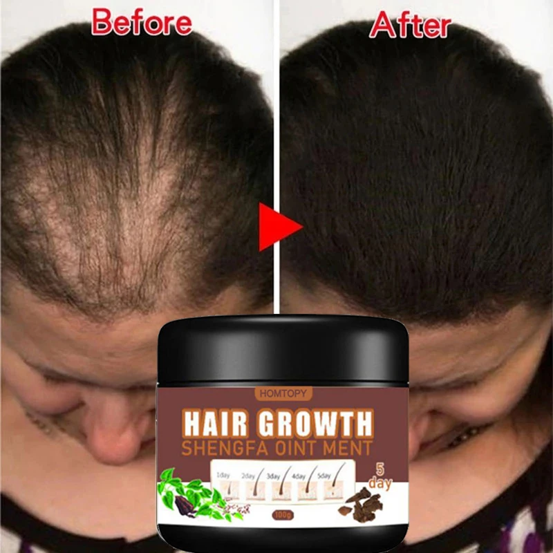 

Fast Hair Growth Cream Anti Hair Loss Treat Repair Damaged Hair Root Anti-Itch Anti-Dandruff Oil Control Smoothing Hair Care