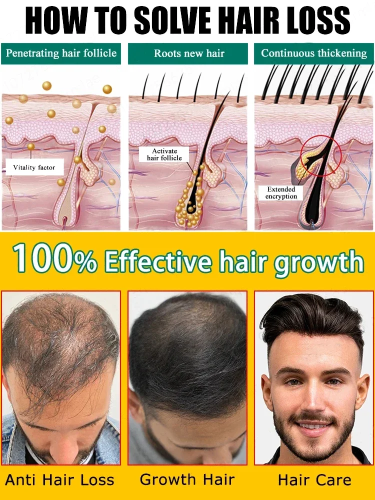 Sérum anti-chute de cheveux pour hommes et femmes, croissance rapide des cheveux, traitement à l'huile capillaire, produits de traitement du cuir chevelu, beauté et santé, vidéo 4