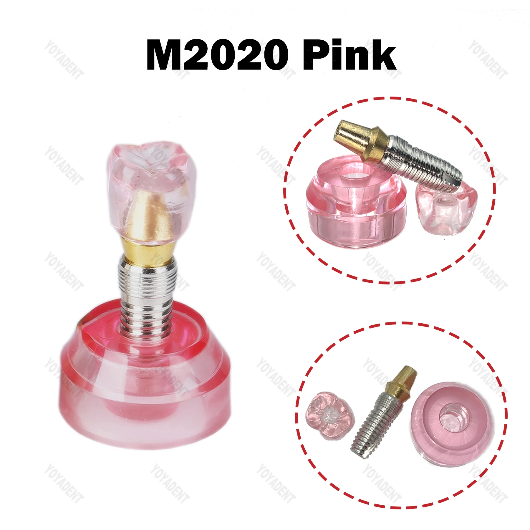 치과 치아 모형 티포돈트 임플란트 교육용 2.5배 확대 레진 모형 (치과의사 환자 상의용 데모)