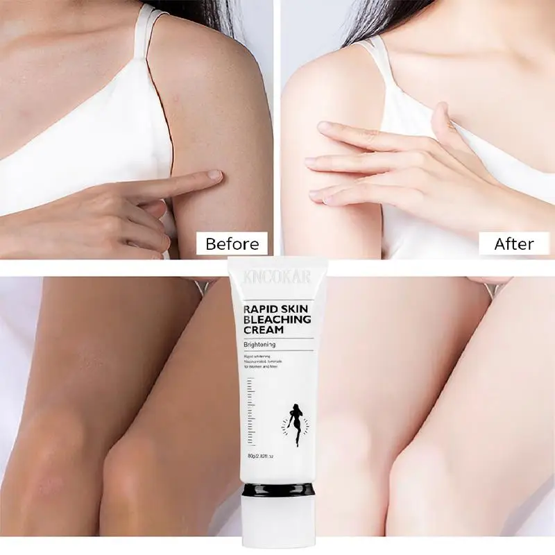 Women Rapid Skin Bleaching Cream Part Pink Underarm Whitening Cream Dark Nipple Anal Bleaching Soothing Repairing Body Lotion 2