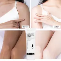 Women Rapid Skin Bleaching Cream Part Pink Underarm Whitening Cream Dark Nipple Anal Bleaching Soothing Repairing Body Lotion 2