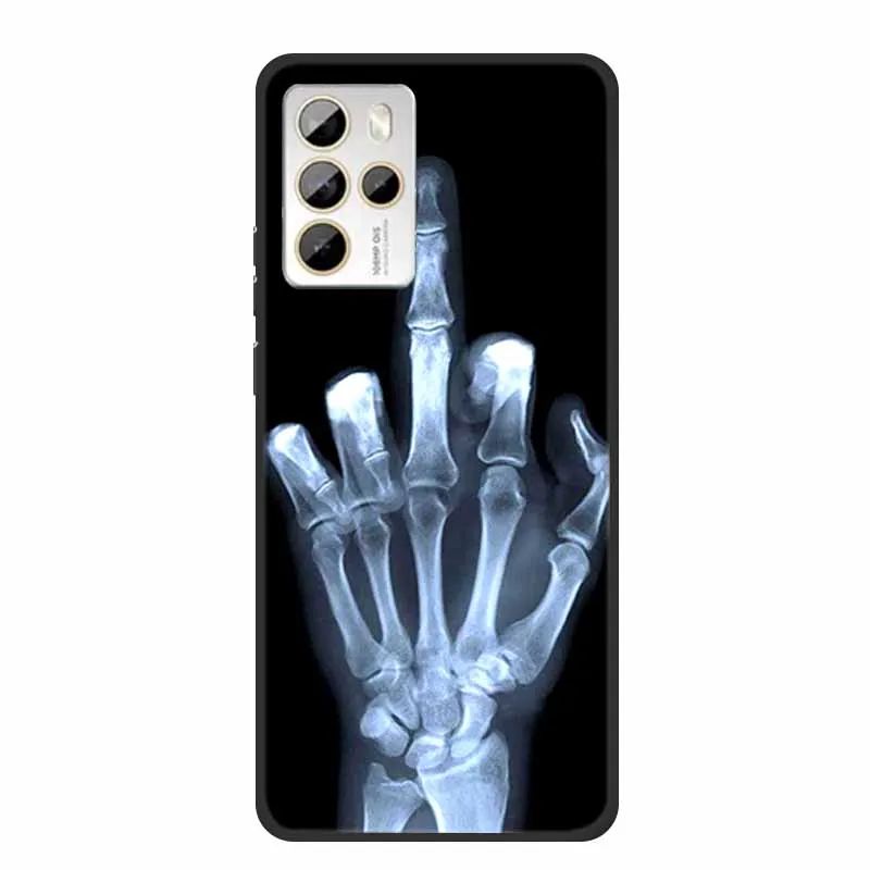 Cartoon Wolf Silicone Soft TPU Phone Case - Animal Design Protector Coque