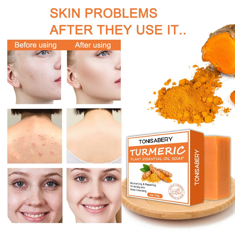 

TONISABERYSoap Face Cleansing Anti Acne Handmade Natural Herbal Ginger Whitening Remove Pimples Dark Spots Oil-Control Body Bath