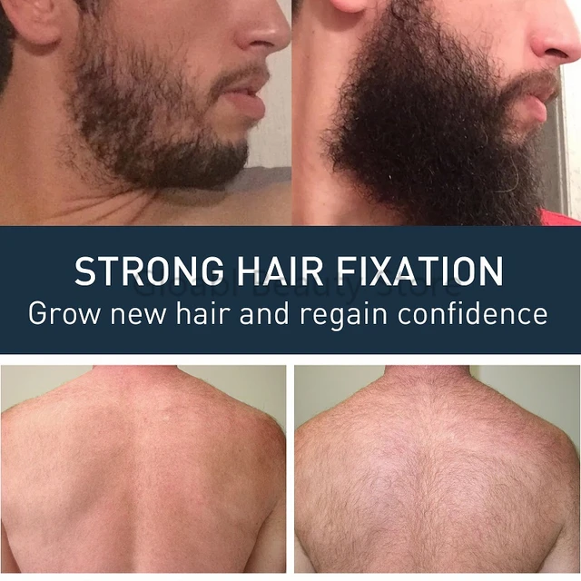 Aggregate 142+ chest hair growth ceg.edu.vn