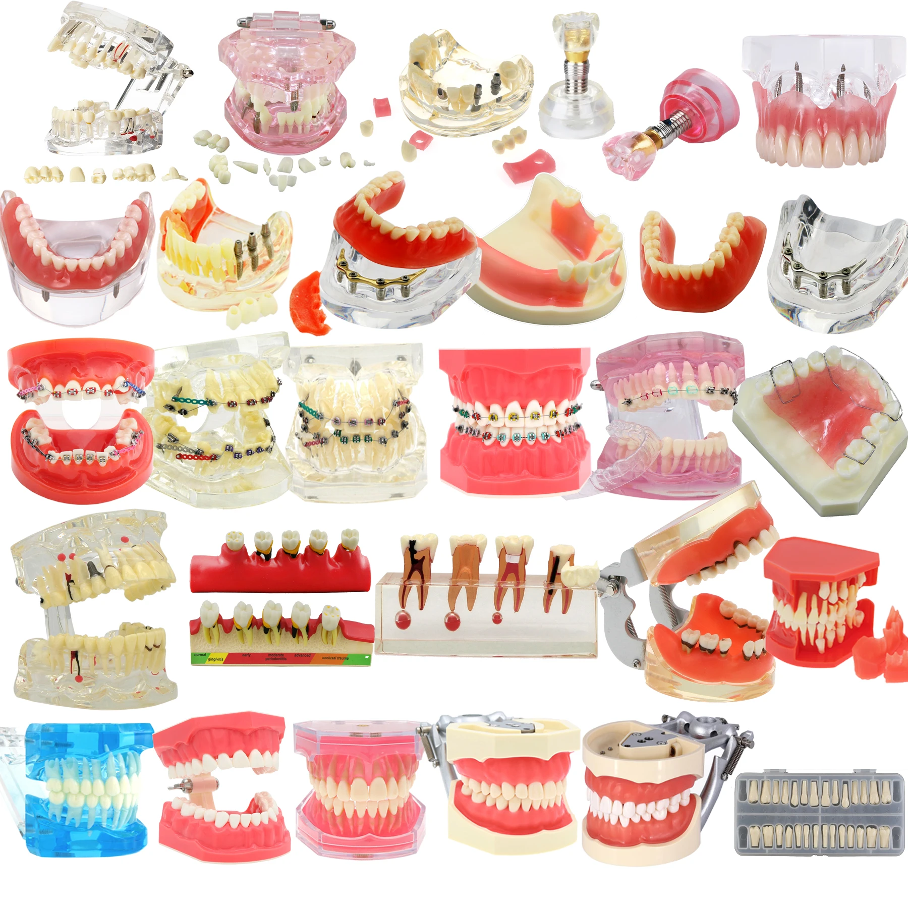 Dental Teeth Model Dental Teaching Model Standard Implants Models Orthodontic Model Dentistry Dentist  Demo Studying