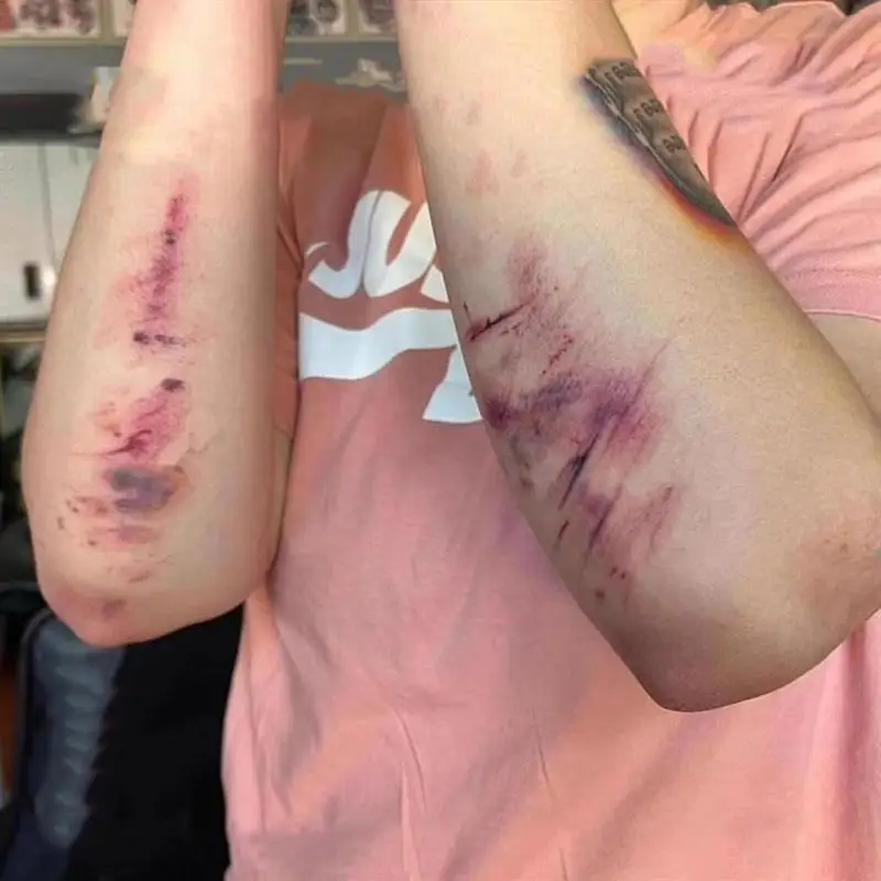 Halloween Wound and Bruising Temporary Tattoo Stickers - Waterproof and Long-Lasting Fake Tattoos