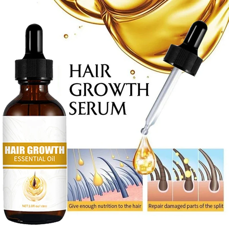 

Fast Hair Growth Hair Growth Oil Effective Baldness Repair Hereditary Loss Postpartum Hair Loss Seborrheic Anti Loss