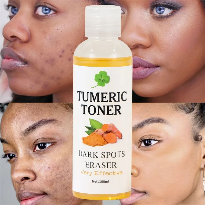 Turmeric Whitening Face Toner Effective Remove Dark Spots Melasma Moisturize Brighten Smooth For Black Skin Tone Beauty Health hot sale 300g pure pearl powder 15 minutes remove spots and acne black heads whitening skin name brand mask for face