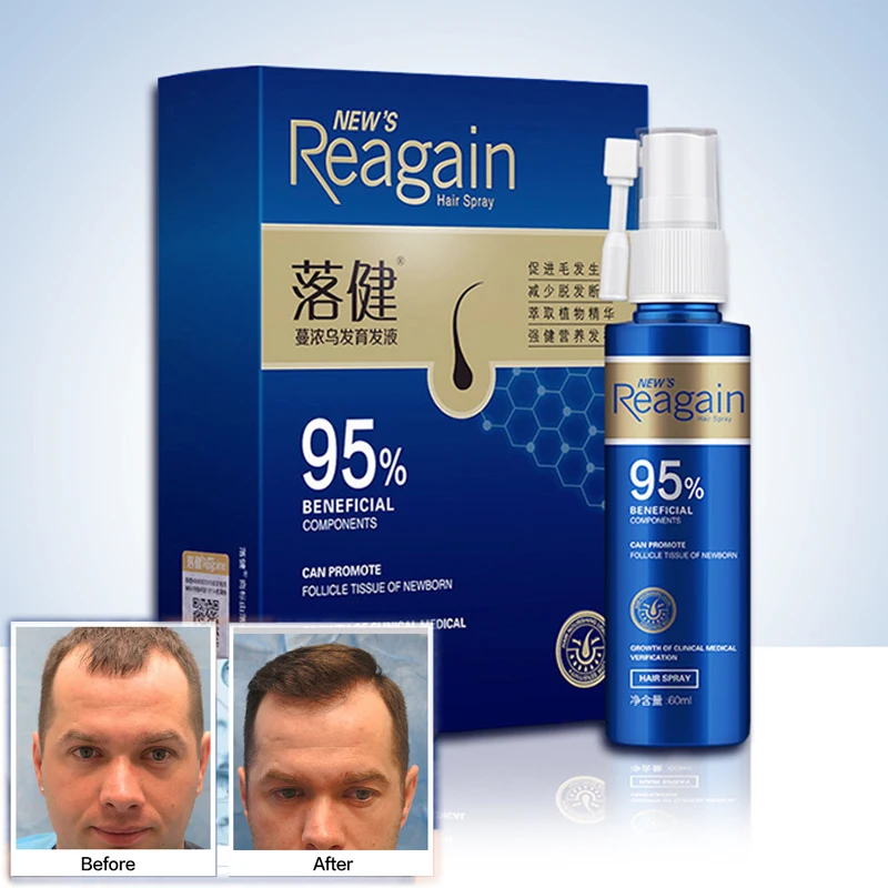 Anti Hair Loss Regrowth Essence Hair Growth Serum Sprayer Hair Regrowth For Men Rapid Growth Essence Prevent Hair From Falling bigaku набор для ухода за волосами rapid help for hair