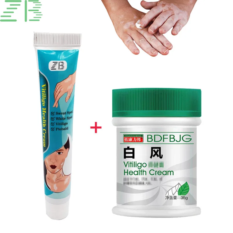 

2 Types Vitiligo Treatment Ointment White Spot Psoriasis Cream Mycosis Leukoplakia Chinese Tradition Herbal Medical Plaster