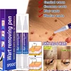 Removing Against Moles Remover Anti Verruca Remedy Liquid Pen Treatment Papillomas Removal Of Warts Liquid From Skin Tags 1