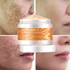Crème éclaircissante contre les taches de rousseur à la vitamine C, élimination instantanée du visage, mélasma, taches foncées, mélanine, hydratant, Anti-âge, éclaircit, beauté, soins de la peau