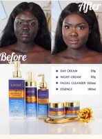 Brilliant Brightening Lotion Set Cleanser Wash Rejuvenating Women Face Lightening Skin Care Set (New) For Dark Skin 2