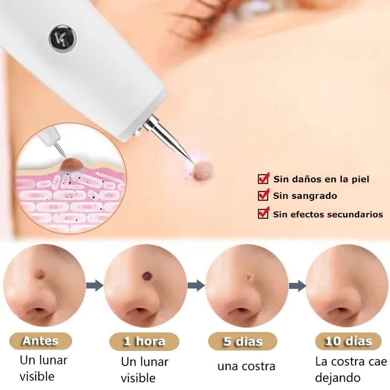 Skin Tag Remover 15 Level Laser Plasma Pen Freckle Mole Warts Removal Lcd Nevus Tattoo Black Spots Remover Blemish Removal