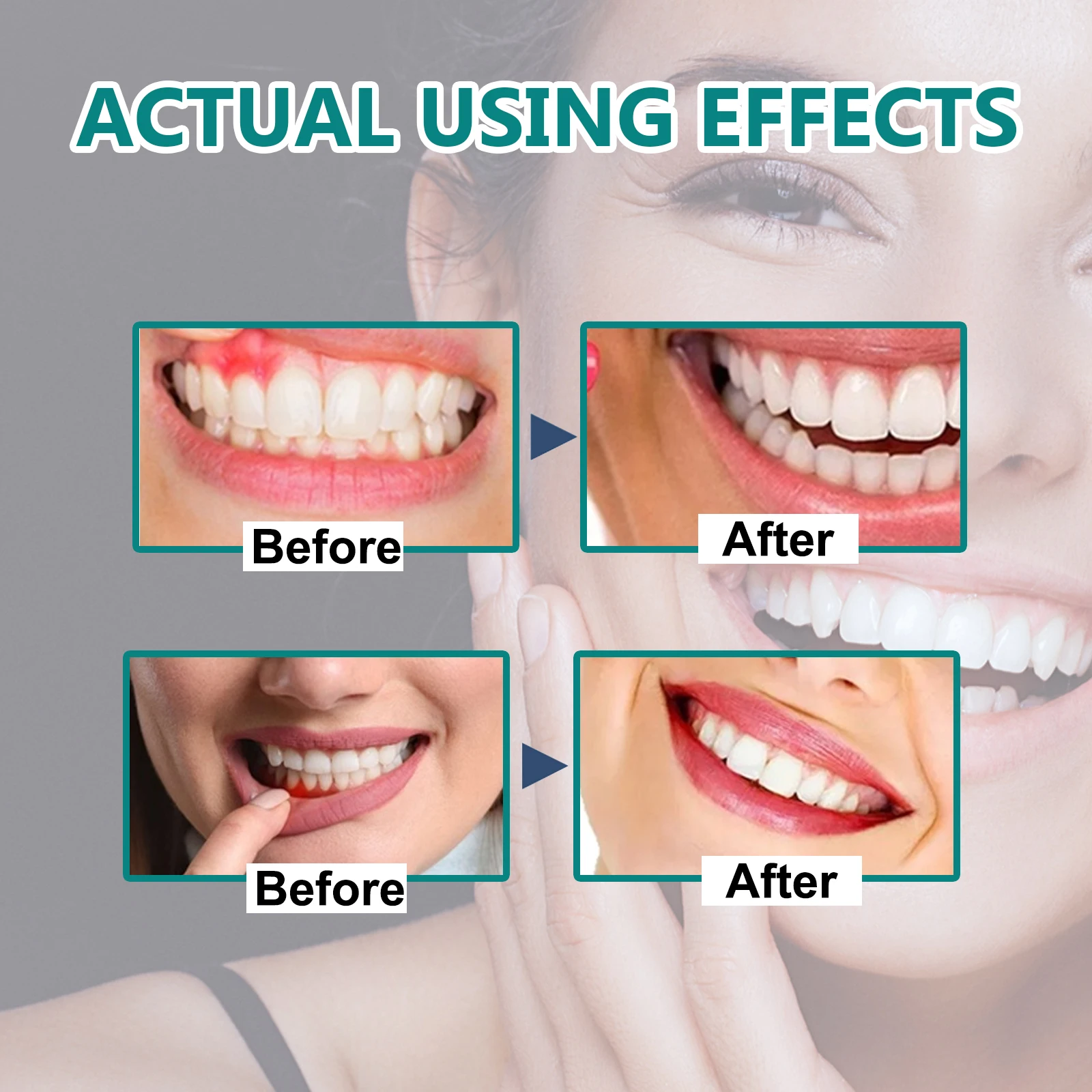 Gingival Repair Drops Repair Cavities Caries Whiten Teeth Remove Plaque Stains Relieve Gums Decay gum repair drops teeth whitening essence teeth whitening product