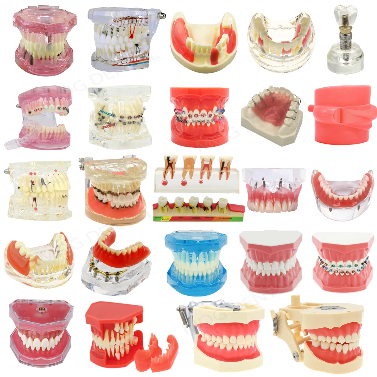 Dental-Teeth-Model-Implant-with-Removable-Dental-Education-Model-for ...