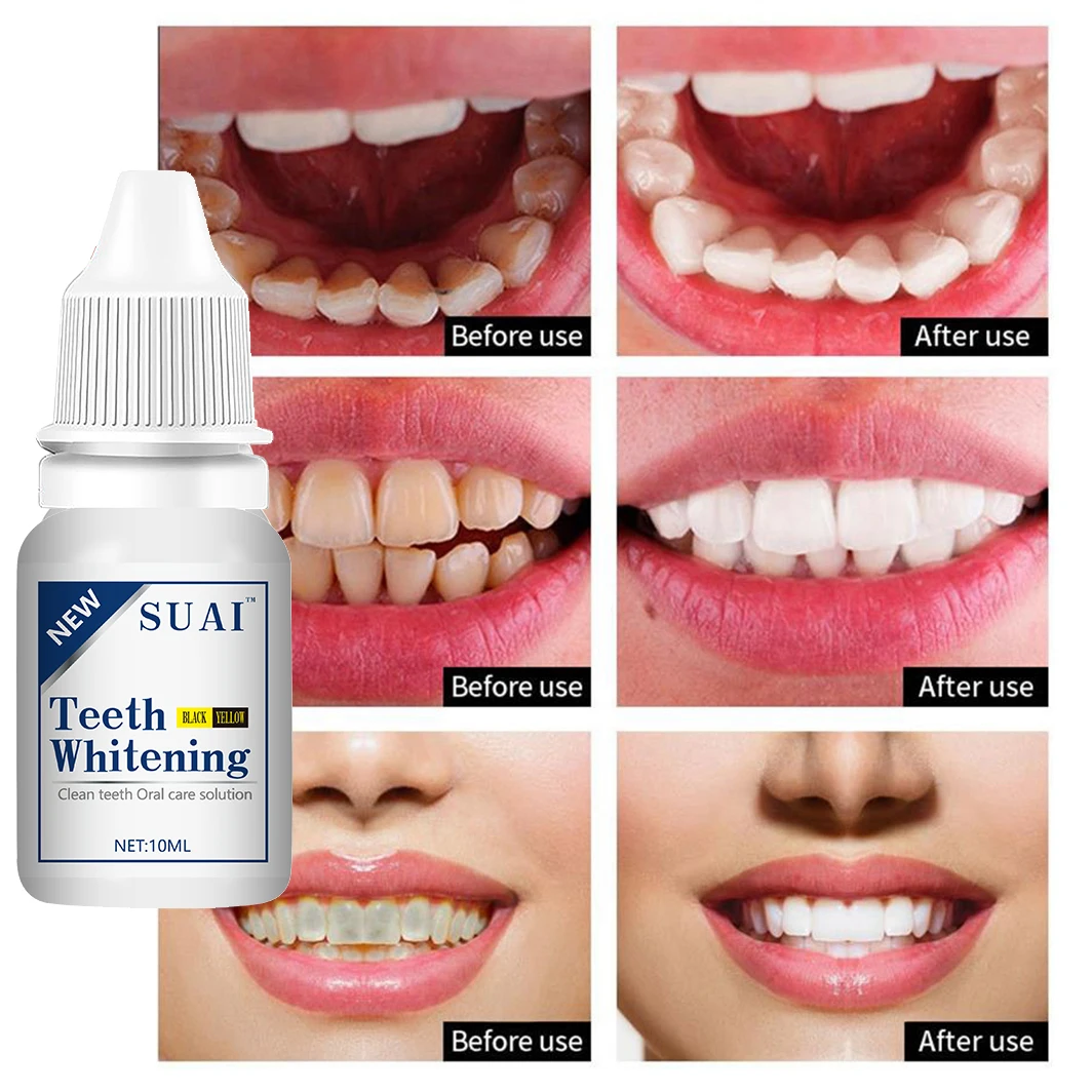 Teeth Whitening Essence Serum Oral Hygiene Care Cleaner Whiten Teeth Whitener Remove Plaque Stains Fresh Breath Dental Tools