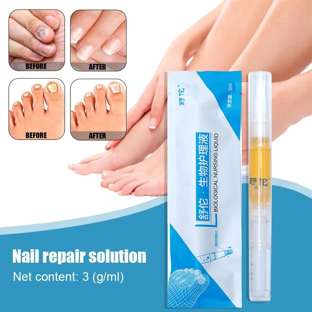 Nail Repair Liquid Pen Fungus Treatment Anti Fungal Repair Biological Solution Onychomycosis Pencil Rehydration Nutrient R2O2