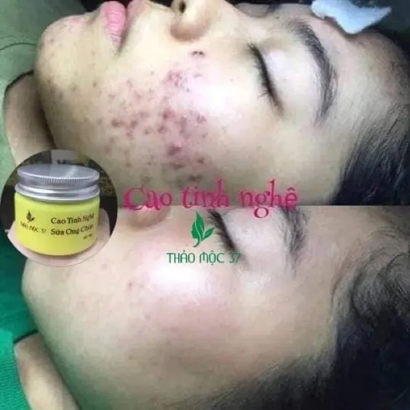 Cao Tinh Ngh Sbrum Sa Og Chua Thatho M?c 37 ()