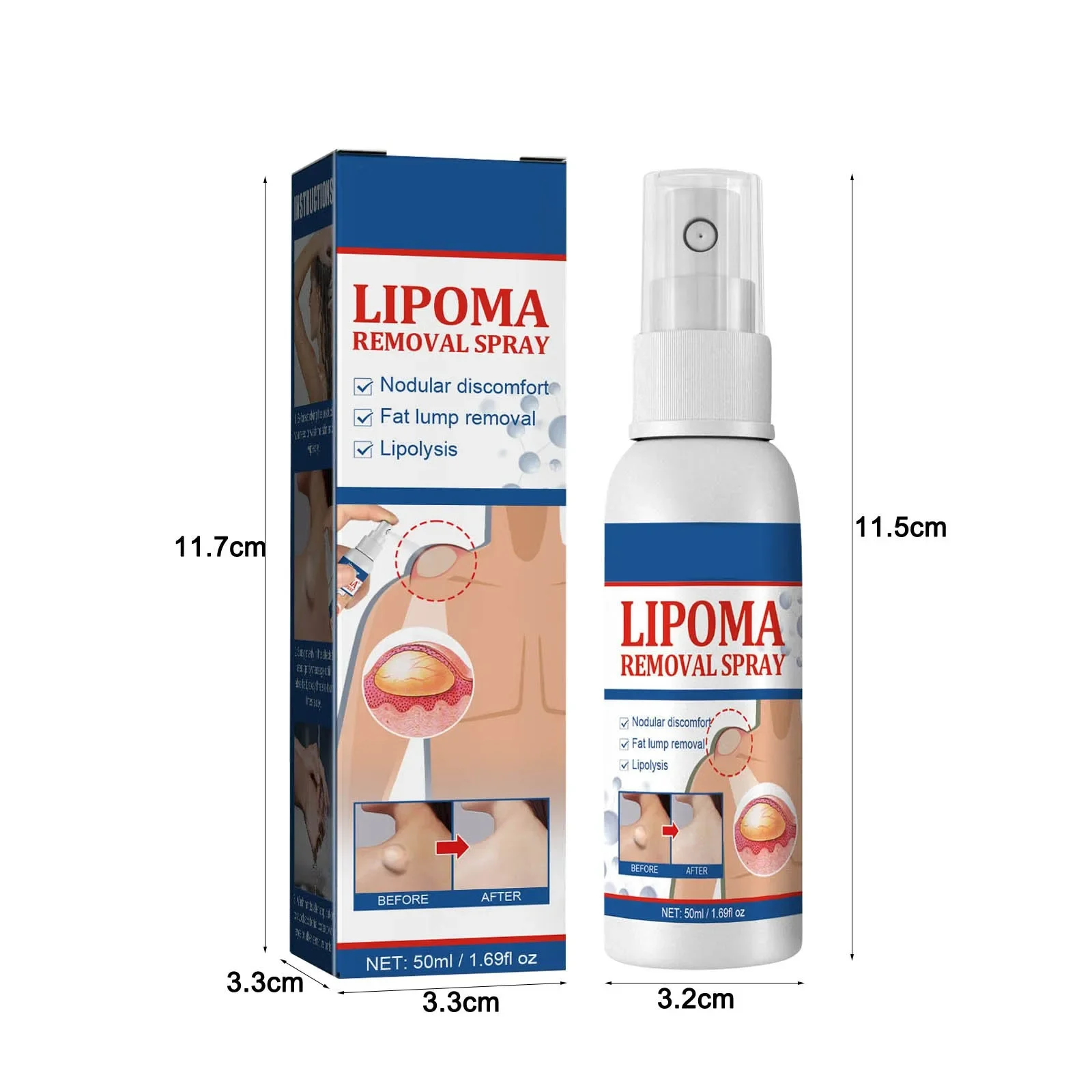 Fat knot Spray Relieves Body Lump Subcutaneous Nodule Dredging Spray Anti Tumor Mitigation Skin Swelling Pain Painless Treatment
