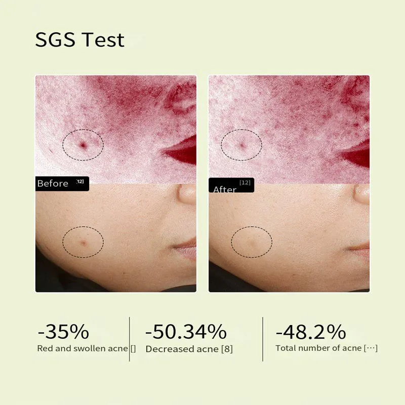 Oligopeptide Repairing Face Serum Facial Anti-Wrinkle Anti-Aging Firming Whitening Acne Treatment Lift Korean Skin Care Products 2
